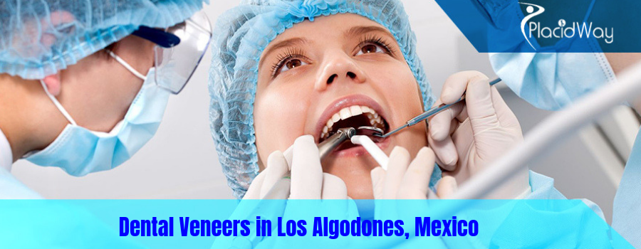 Dental Veneers in Los Algodones, Mexico
